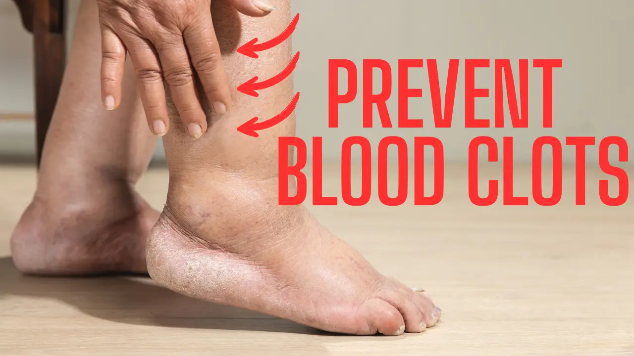 How to Prevent Blood Clots on Long Flights